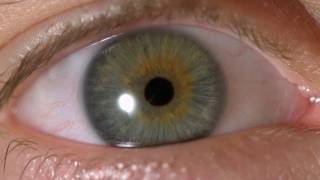 My Iris Wobbles! - Eye In Slow Motion