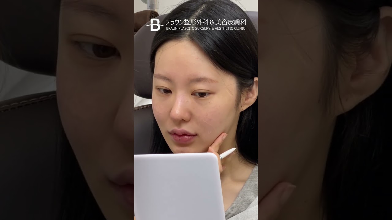 体験団┃リフティング┃たるんで丸いVラインの即刻的な改善を✨️┃サーマクールFLX┃ブラウン美容皮膚科┃ #美容 #垢抜け #渡韓 #リフトアップ #韓国 #肌 #肌管理 #たるみ #たるみ改善