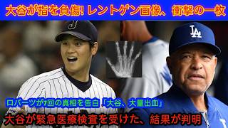 🚨😱 大谷翔平が指を負傷!? 衝撃の検査結果に騒然！🩻💥😢 ロバーツ監督が告白…「大谷は痛みに耐えられなかった」💔😭 フリーマンも涙…⚠️ 大谷の今後に注目！