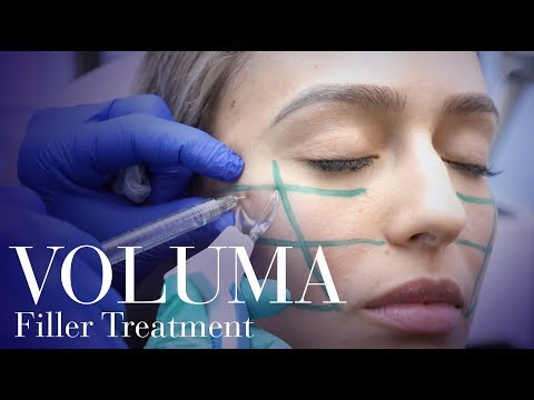 Juvederm Voluma With Lidocaine Fillers
