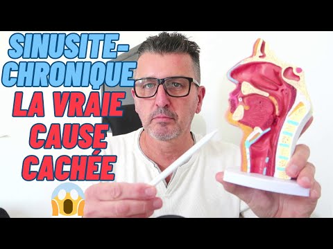 SINUSITE-CHRONIQUE: Le Signal d'Alarme d'Un Corps "MALADE"