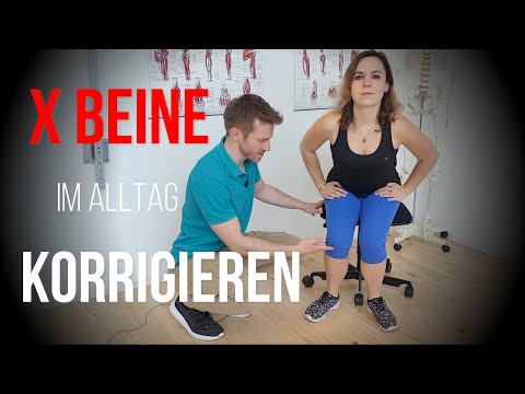 X Beine korrigieren (einfache Übung für Alltag)