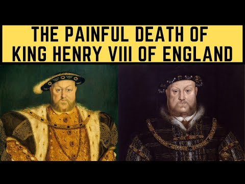 The PAINFUL Death Of King Henry VIII Of England