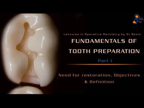 Fundamentals Of Tooth Preparation - Part 1