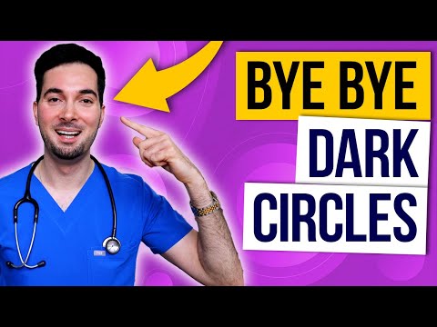 How to get rid of dark circles under eyes with a home remedy