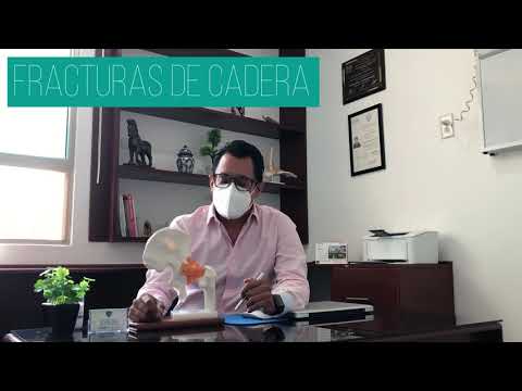 FRACTURA DE CADERA