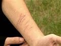 (Self Harm Song) Please Don't Cut (Official ...