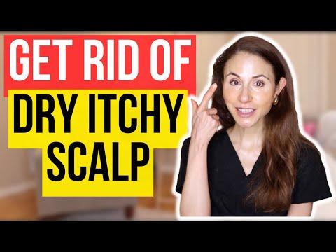 Get Rid Of Dry Itchy Scalp FAST!