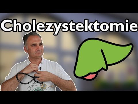Der Code der Cholezystektomie - Fachbegriff kurz entschlüsselt!