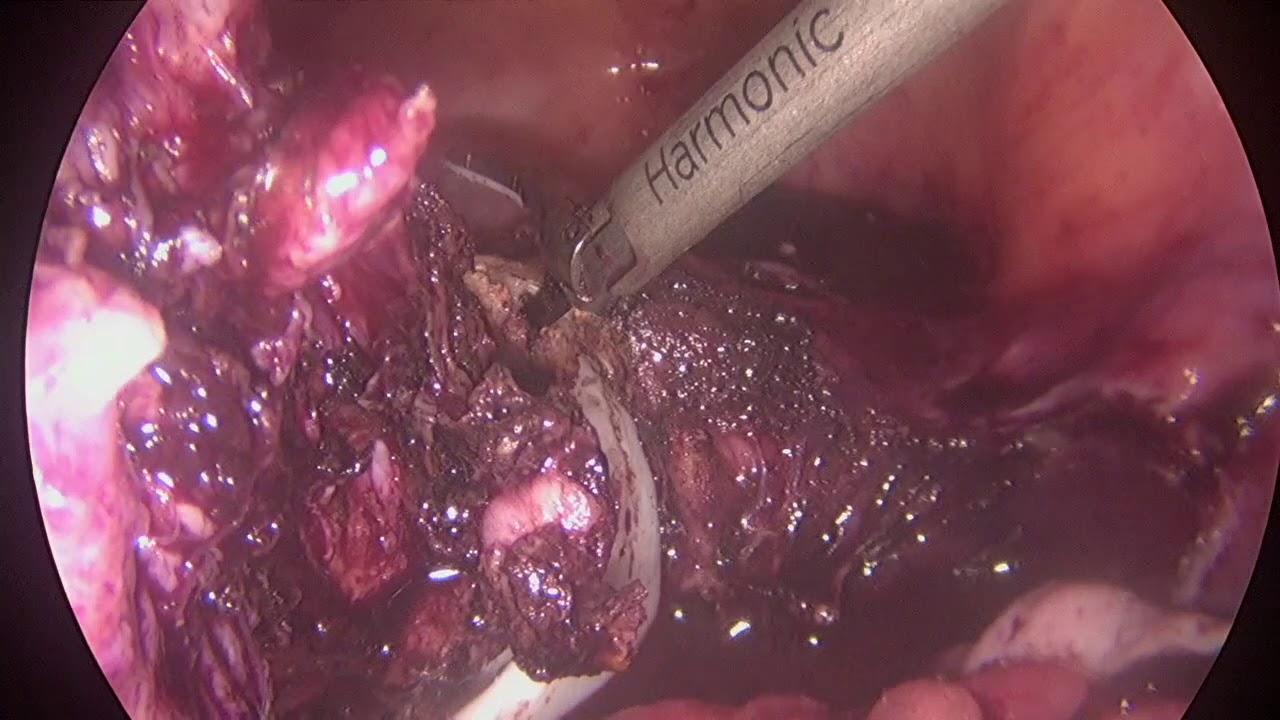 Germán Gabriel Palacios López-43