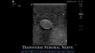 Product video: CAE Blue Phantom Central Line Ultrasound Training Models