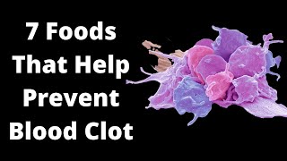 7 Foods That Help Prevent Blood Clot (Blood Thinning Foods) | VisitJoy