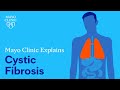 Mayo Clinic Explains Cystic Fibrosis