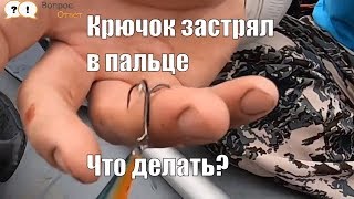 Как достать рыболовный крючок из пальца