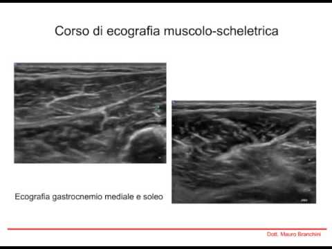 La temperatura corporea è aumentato durante linfiammazione delle articolazioni Discus traumel osteocondrosi