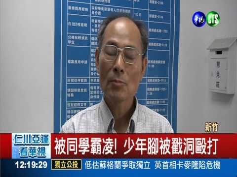 又見校園霸凌! 少年被虐險截肢