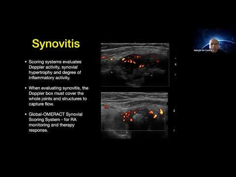 Dr  Jeimylo De Castro talks about Spectrum of pediatric MSK Ultrasound