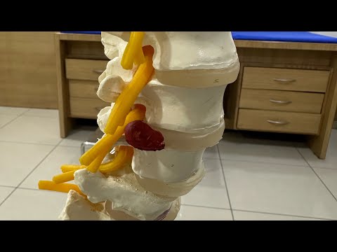  What is UBE Spine Endoscopy.