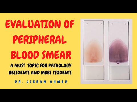 OSTEOGENIC TX II FLETCHERS 5TH E II ROBBINS 10TH E II POST GRADUATE LEARNING II DrJIBRANAHMED
