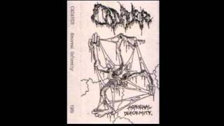 Cadaver - Abnormal Deformity (demo)