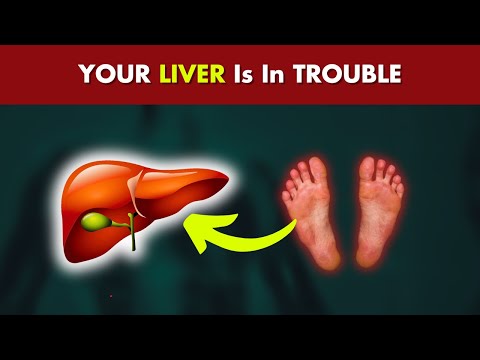 How Your Feet Are Warning You About Your Liver Problems!