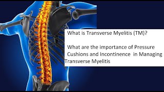 Transverse Myelitis