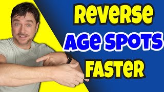 Finally FADE Dark Age Spots On Arms Faster! | Chris Gibson