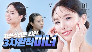 Facial contouring surgery, double eyelid surgery, rhinoplasty | DL Plastic Surgery