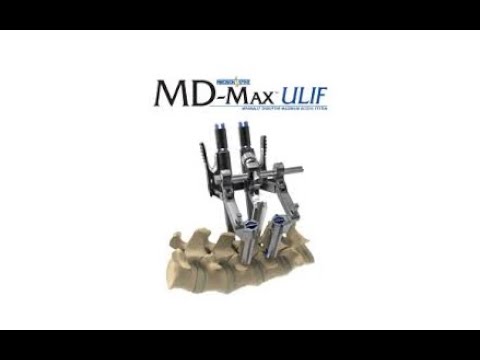 Precision Spine: MD Max ULIF System