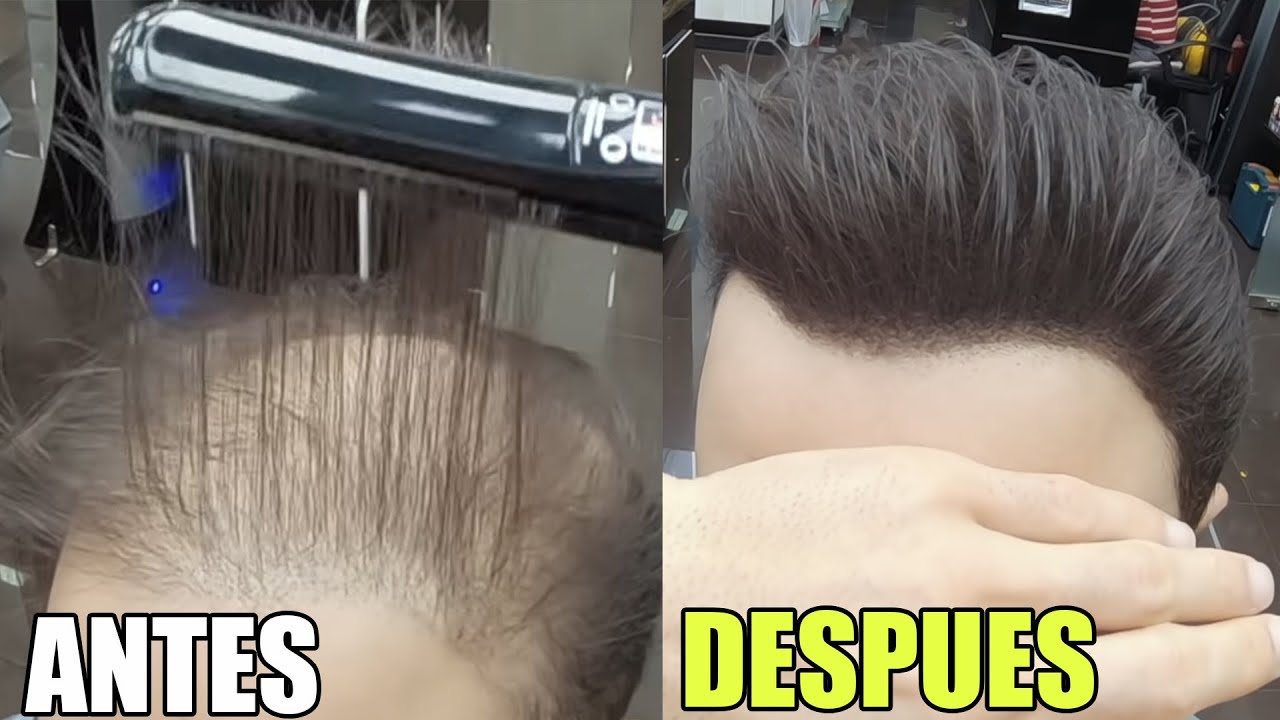 CAMBIO DE LOOK EXTREMO DIA DE SU BODA | Su MUJER no lo reconoce LE CRECE PELO