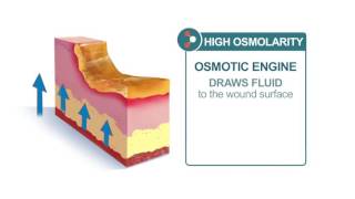 Product video: MEDIHONEY HoneyColloid Leptospermum Hydrocolloid Dressings