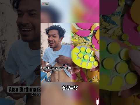 Tag your Friends jisko Birthmark hai #trending