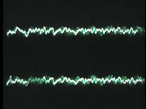 THIS IS US--TRUCKIN' w/ CASEY JONES