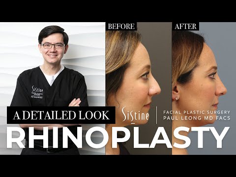 Dr. Leong photoshopped next to a before and after image