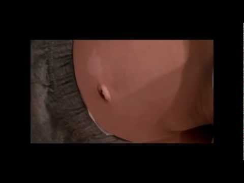 Boy was born with Apple Logo (pigment disorder)new  iPhone iPad ((watch in 1080p HD))