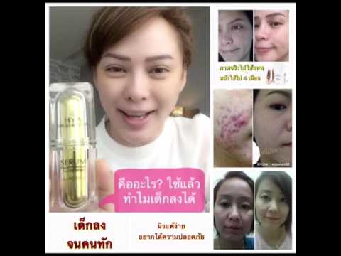 วิธีการเพิ่มหน้าอกของผู้หญิง เต้านม implants eurosilicone