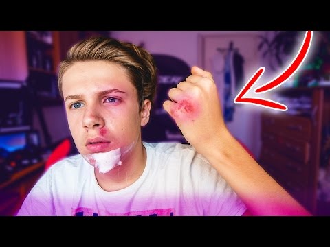 AM AJUNS LA SPITAL !!!