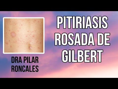 Pitiriasis rosada de Gilbert, ¿qué es? ¿hay que hacer algo?