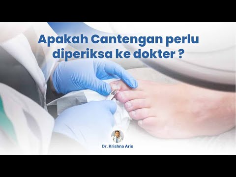 Apakah Cantengan perlu diperiksa ke dokter ?