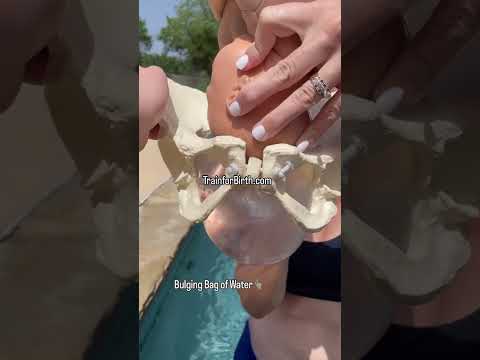 Childbirth Tips & Pregnancy Training: Bulging Bag of Water