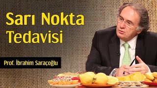 Sarı Nokta Tedavisi | Prof. İbrahim Saraçoğlu