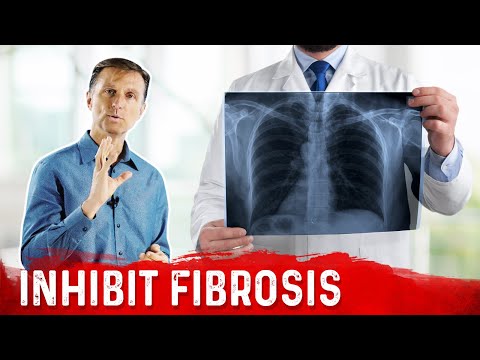 Vitamin E Inhibits Scar Tissue – Benefits of Vitamin E for Fibrosis – Dr.Berg