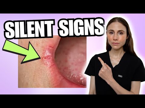 What Your Skin Is Trying to Tell You: Dermatologist Explains Common Signs