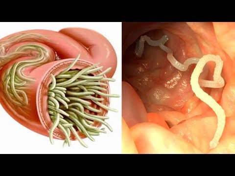 7 herbs that can kill internal parasites naturally