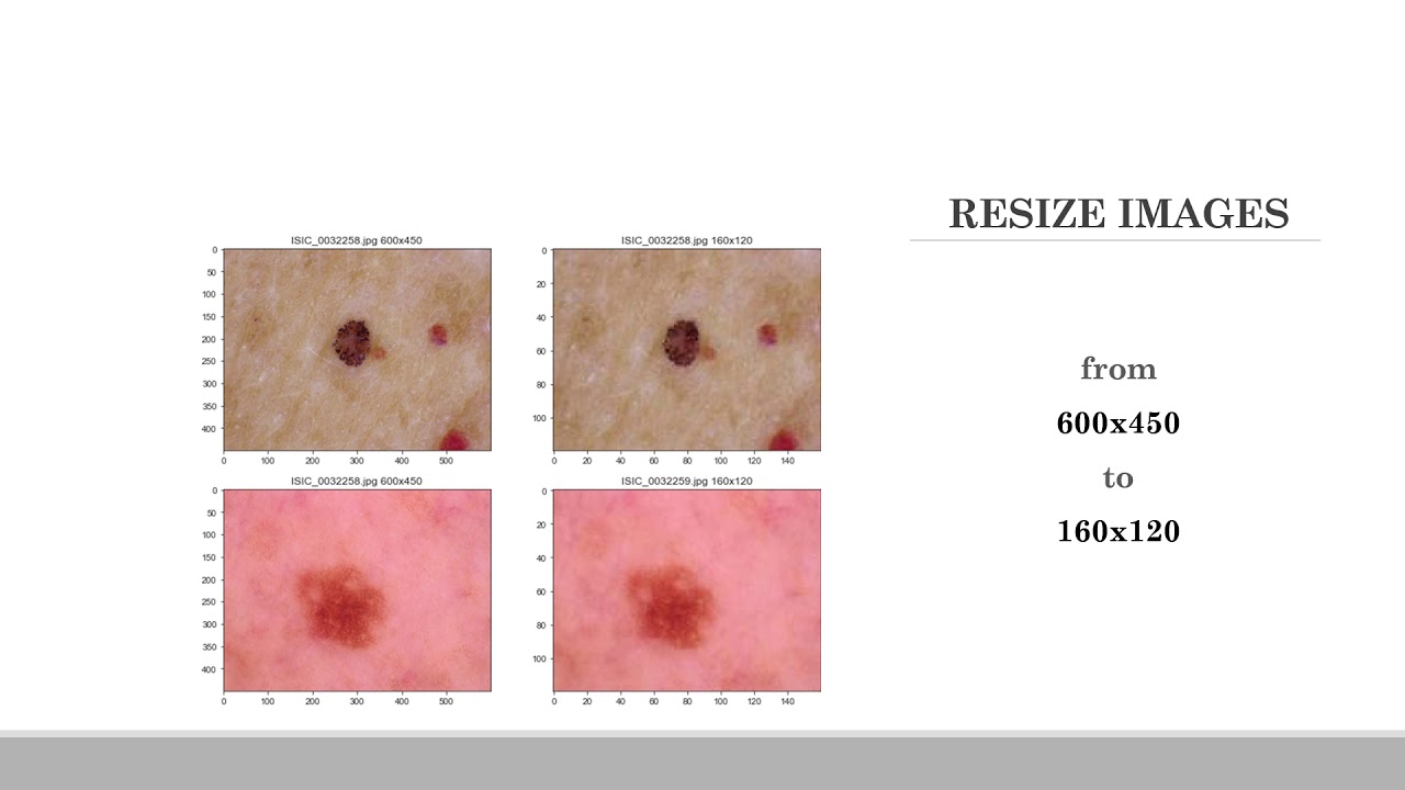 A CNN Dermoscopic Image Classification HAM10000