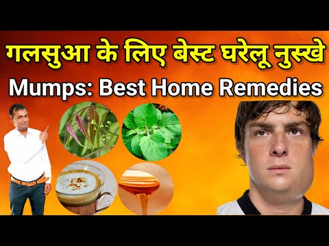 Mumps Treatment: Home Remedies & Prevention Tips | Dr Umesh Raghatate