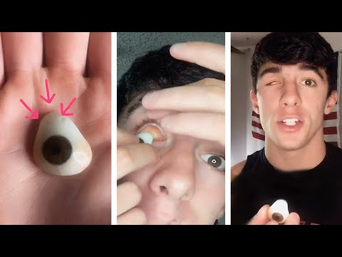 What It's Like To Have A Prosthetic Eye