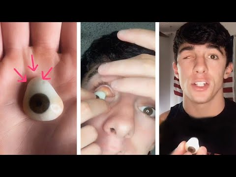 裝上假眼是什麼感覺？ (What It's Like To Have A Prosthetic Eye)