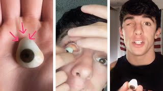 What It&#39;s Like To Have A Prosthetic Eye