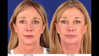 Shapiro Plastic Surgery